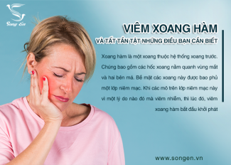 Viêm xoang hàm và tất tần tật những điều bạn cần biết